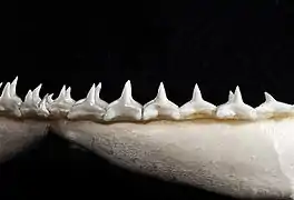 Lower teeth