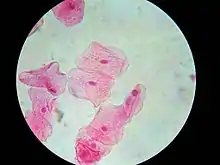 Human cheek cells (Nonkeratinized stratified squamous epithelium) 500×