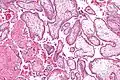 Micrograph showing chorionic villi. Intermediate magnification. H&E stain.