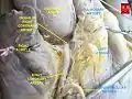 Right coronary artery