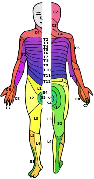 A person with dermatomes mapped out on the skin