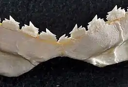 Lower teeth