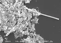 The SOS response inhibits septum formation until bacterial DNA can be repaired and is observable as filamentation when cells are examined by microscopy (top right of image).