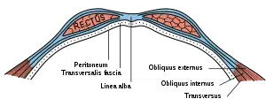 Diagram of sheath of Rectus.