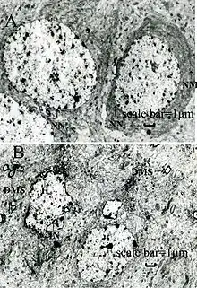 Two black-and-white photos; one shows dark, fairly regular rings on a lighter background, and the other shows irregular, smaller, and not as dark clusters.