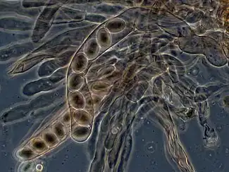 Microscopic view of numerous translucent or transparent elongated sac-like structures each containing eight spheres lined up in a row