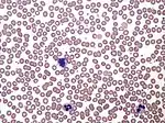 Normal human blood film