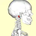 Lateral view. Still image.