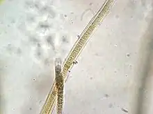 Heterocyst of Scytonema crispum