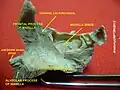 Frontal process of maxilla