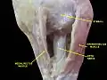 Optic nerve.Deep dissection.Inferior view.