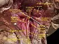 Muscles, arteries and nerves of neck.Newborn dissection.