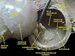 Hip joint. Lateral view. Femur head