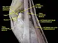 Dorsum of Foot. Ankle joint. Deep dissection