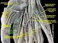 Adductor pollicis muscle