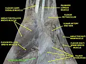 Lumbricals muscle