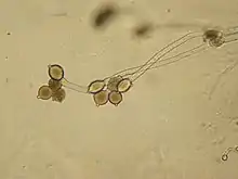 Dichotomously branched thallus of Allomyces sp. At the ends of the branches are two to three orange-brown sporangia stacked on top of each other. Each sporangium has two discharge papillae. The sporangia at the top of the stacks have apical discharge papillae. The sporangia on the bottom of the stacks have lateral discharge papillae.