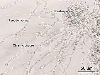 Chlamydospory Candida albicans